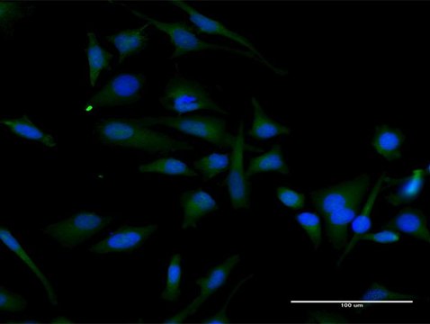 Anti-CCND2 antibody produced in rabbit purified immunoglobulin, buffered aqueous solution