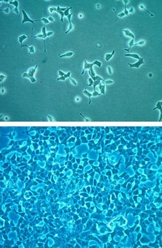 INS-1 832/13 Rat Insulinoma Cell Line INS-1 832/13 rat insulinoma cell line is a useful model for insulin secretion regulation and pancreatic islet beta-cell function studies.