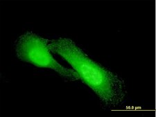 Monoclonal Anti-NDRG1 antibody produced in mouse clone 2D7, purified immunoglobulin, buffered aqueous solution