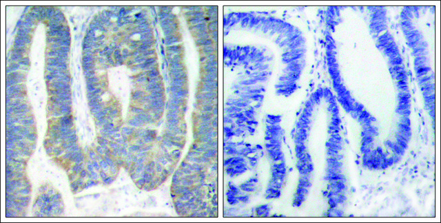 Anti-EIF2AK2 (Ab-451) antibody produced in rabbit affinity isolated antibody