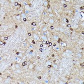 Anti-Argonaute-2 antibody produced in rabbit