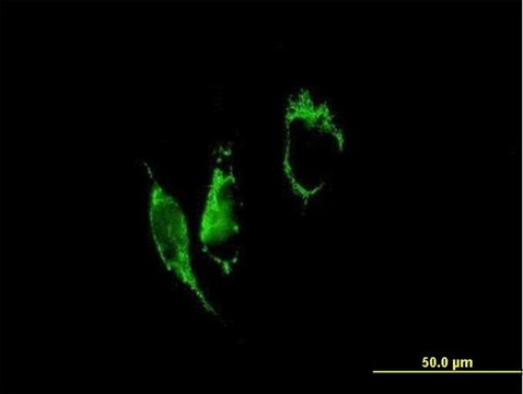 Anti-PYCR1 antibody produced in mouse purified immunoglobulin, buffered aqueous solution