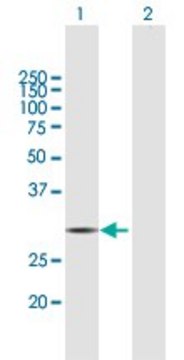 Anti-HDHD2 antibody produced in mouse purified immunoglobulin, buffered aqueous solution