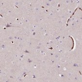 Anti-SLC4A1 antibody produced in rabbit Prestige Antibodies&#174; Powered by Atlas Antibodies, affinity isolated antibody, buffered aqueous glycerol solution