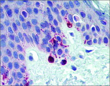 Anti-TYRP1 antibody produced in rabbit affinity isolated antibody