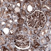 Monoclonal Anti-ZYX antibody produced in mouse Prestige Antibodies&#174; Powered by Atlas Antibodies, clone CL2502, purified immunoglobulin, buffered aqueous glycerol solution