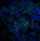 Anti-ST2 antibody produced in rabbit affinity isolated antibody, buffered aqueous solution