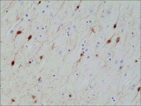 Anti-Calretinin (CALB2) antibody, Rabbit monoclonal recombinant, expressed in HEK 293 cells, clone RM324, purified immunoglobulin