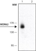 Monoclonal Anti-WDR62 antibody produced in mouse ~1.0&#160;mg/mL, clone 3G8, purified immunoglobulin, buffered aqueous solution