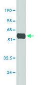 Monoclonal Anti-TNF antibody produced in mouse clone M1-C4, purified immunoglobulin, buffered aqueous solution