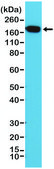 Anti-EGF Receptor antibody, Rabbit Monoclonal recombinant, expressed in HEK 293 cells, clone RM294, purified immunoglobulin