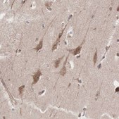 Anti-INF2 antibody produced in rabbit Prestige Antibodies&#174; Powered by Atlas Antibodies, affinity isolated antibody, buffered aqueous glycerol solution