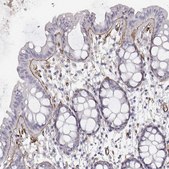 Monoclonal Anti-LAMC1 antibody produced in mouse Prestige Antibodies&#174; Powered by Atlas Antibodies, clone CL3199, purified immunoglobulin, buffered aqueous glycerol solution