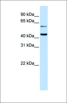 Anti-CMAS antibody produced in rabbit affinity isolated antibody