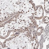 Anti-TBX5 antibody produced in rabbit Prestige Antibodies&#174; Powered by Atlas Antibodies, affinity isolated antibody, buffered aqueous glycerol solution