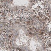 Monoclonal Anti-LAMB1 antibody produced in mouse Prestige Antibodies&#174; Powered by Atlas Antibodies, clone CL2970, purified immunoglobulin, buffered aqueous glycerol solution