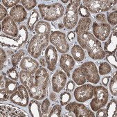 Anti-COA7 antibody produced in rabbit Prestige Antibodies&#174; Powered by Atlas Antibodies, affinity isolated antibody, buffered aqueous glycerol solution, ab2
