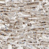 Anti-ASAH1 antibody produced in rabbit Prestige Antibodies&#174; Powered by Atlas Antibodies, affinity isolated antibody, buffered aqueous glycerol solution