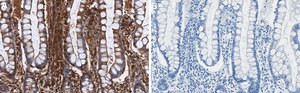 Anti-RIP1/RIPK1 Antibody, clone 1N16 ZooMAb&#174; Rabbit Monoclonal recombinant, expressed in HEK 293 cells