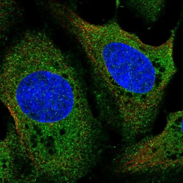 Anti-LDHD antibody produced in rabbit Prestige Antibodies&#174; Powered by Atlas Antibodies, affinity isolated antibody