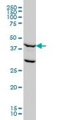 Monoclonal Anti-FEN1 antibody produced in mouse clone 1E2, ascites fluid