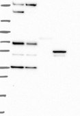 Anti-DPP4 antibody produced in rabbit Prestige Antibodies&#174; Powered by Atlas Antibodies, affinity isolated antibody, buffered aqueous glycerol solution