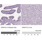 Anti-DNAH12 antibody produced in rabbit Prestige Antibodies&#174; Powered by Atlas Antibodies, affinity isolated antibody, buffered aqueous glycerol solution