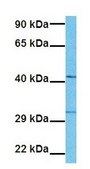 Anti-CRBN, (N-terminal) antibody produced in rabbit affinity isolated antibody