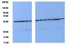 Anticorps anti-tubuline, clone YL1/2 clone YL1/2, Chemicon&#174;, from rat