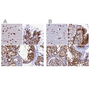 Anti-DDX1 antibody produced in rabbit Prestige Antibodies&#174; Powered by Atlas Antibodies, affinity isolated antibody, buffered aqueous glycerol solution