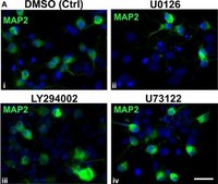 Anti-MAP2 Antibody, clone AP20 clone AP20, Chemicon&#174;, from mouse
