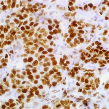 EZH2 (11) Mouse Monoclonal Antibody