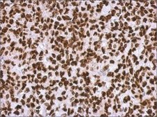 Anti-HMGA2 antibody produced in rabbit