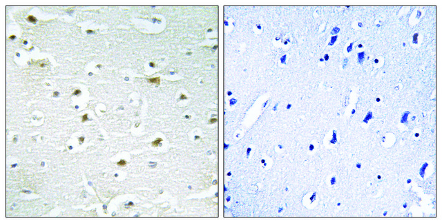 Anti-DDX3Y antibody produced in rabbit affinity isolated antibody