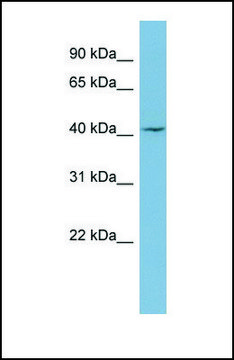 Anti-LASS1 antibody produced in rabbit affinity isolated antibody