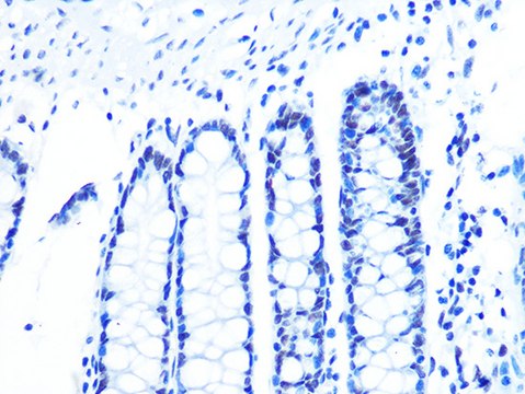 Anti-U2AF2/U2AF65 Antibody, clone 8E8R9, Rabbit Monoclonal