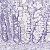 Anti-SI antibody produced in rabbit Prestige Antibodies&#174; Powered by Atlas Antibodies, affinity isolated antibody, buffered aqueous glycerol solution