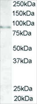 Anti-AKAP3/SOB1 antibody produced in goat affinity isolated antibody, buffered aqueous solution