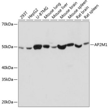 Anti-AP2M1 Antibody, clone 10J8D1, Rabbit Monoclonal