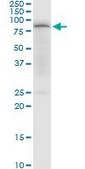 Anti-PDPK1 antibody produced in mouse purified immunoglobulin, buffered aqueous solution