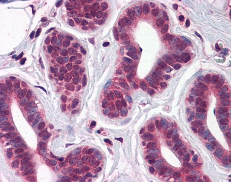 Anti-TBX18 (ab2) antibody produced in rabbit affinity isolated antibody
