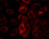 Anti-p62/SQSTM1 antibody produced in rabbit ~1&#160;mg/mL, affinity isolated antibody, buffered aqueous solution