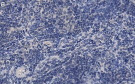 Anti-ROR&#947; Antibody, clone 6F3.1 ZooMAb&#174; Mouse Monoclonal recombinant, expressed in HEK 293 cells