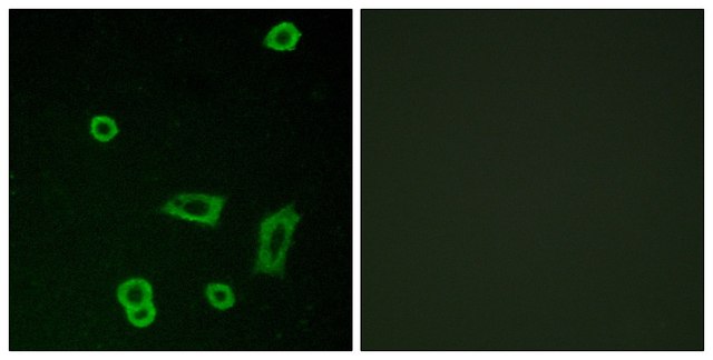 Anti-MTR1L antibody produced in rabbit affinity isolated antibody