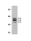 Anticorps anti-Tau (isoforme&nbsp;RD4 à 4&nbsp;répétitions), clone&nbsp;1E1/A6 culture supernatant, clone 1E1/A6, Upstate&#174;