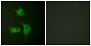 Anti-p15 INK antibody produced in rabbit affinity isolated antibody