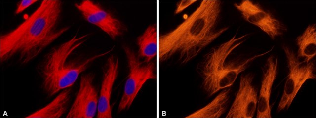 Monoclonal Anti-Vimentin&#8722;Cy3 antibody produced in mouse clone V9, purified immunoglobulin, buffered aqueous solution