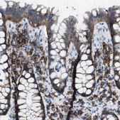 Anti-SDC1 antibody produced in rabbit Prestige Antibodies&#174; Powered by Atlas Antibodies, affinity isolated antibody, buffered aqueous glycerol solution