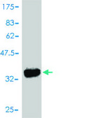 Monoclonal Anti-ROR1 antibody produced in mouse clone 2F8, purified immunoglobulin, buffered aqueous solution