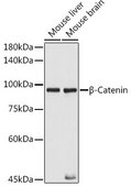 Anti- &#946;-Catenin antibody produced in mouse